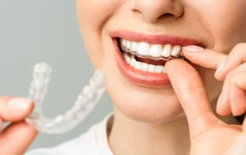 Understanding Treatment Times: Insights from an Orthodontist Near Me in Thornton