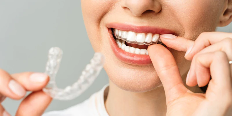 Orthodontist Near Me in Thornton